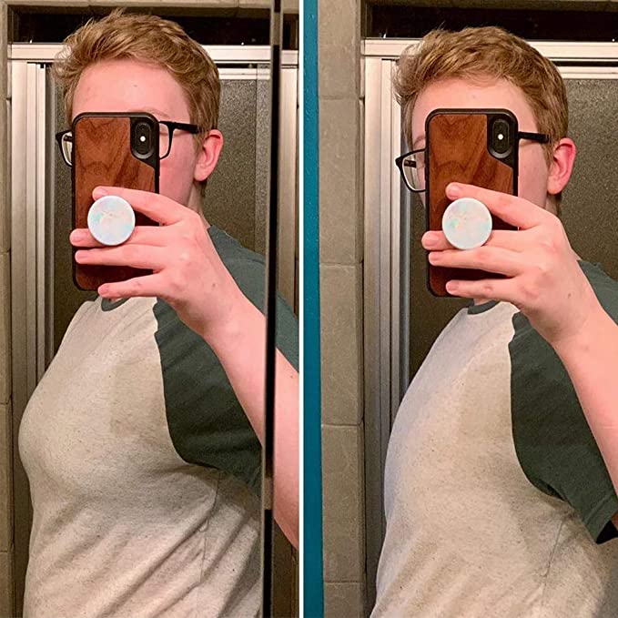 Ftm Binders Before And After